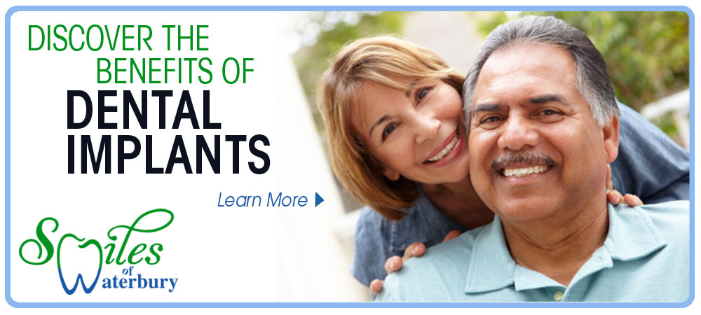 Dental Implants | Smiles of Waterbury