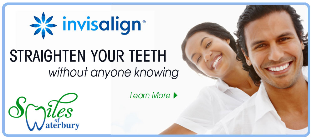 Invisalign | Smiles of Waterbury